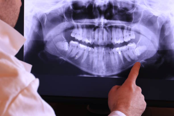 Emergency Dentist Open Today in WA